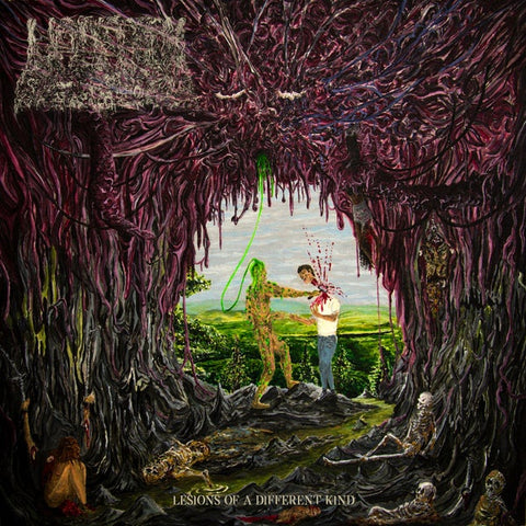 UNDEATH-LESIONS OF A DIFFERENT KIND SLIME GREEN VINYL  LP *NEW*