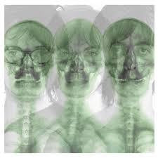 SUPERGRASS-SUPERGRASS CD VG