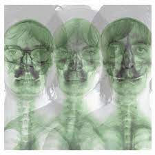 SUPERGRASS-SUPERGRASS 2CD *NEW*